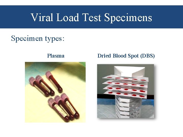 Viral Load Test Specimens Specimen types: Plasma Dried Blood Spot (DBS) 