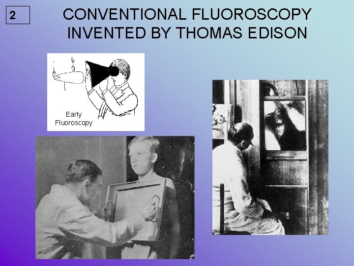 2 CONVENTIONAL FLUOROSCOPY INVENTED BY THOMAS EDISON Early Fluoroscopy 