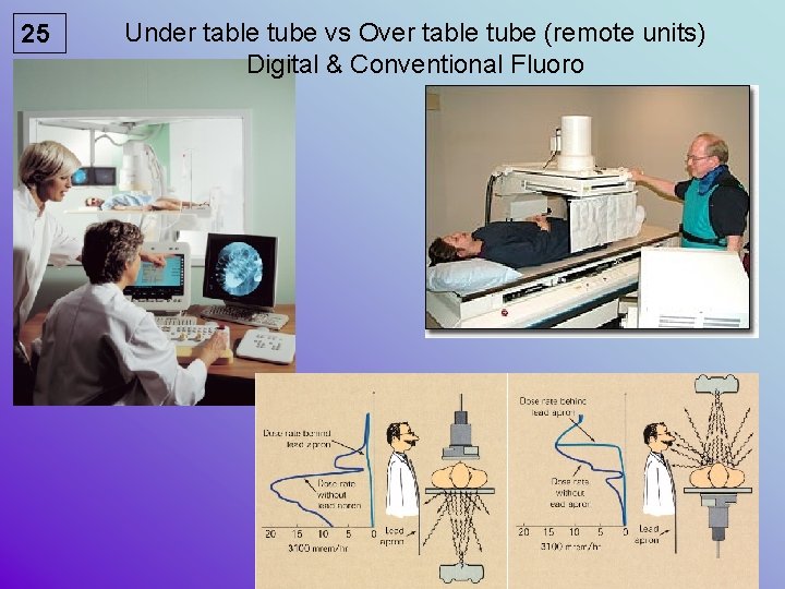 25 Under table tube vs Over table tube (remote units) Digital & Conventional Fluoro