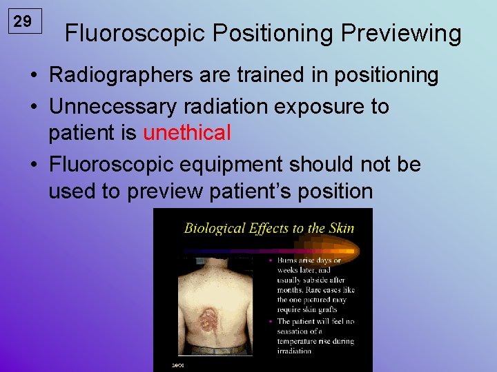 29 Fluoroscopic Positioning Previewing • Radiographers are trained in positioning • Unnecessary radiation exposure
