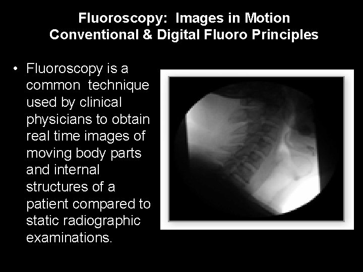 4 Fluoroscopy: Images in Motion Conventional & Digital Fluoro Principles • Fluoroscopy is a