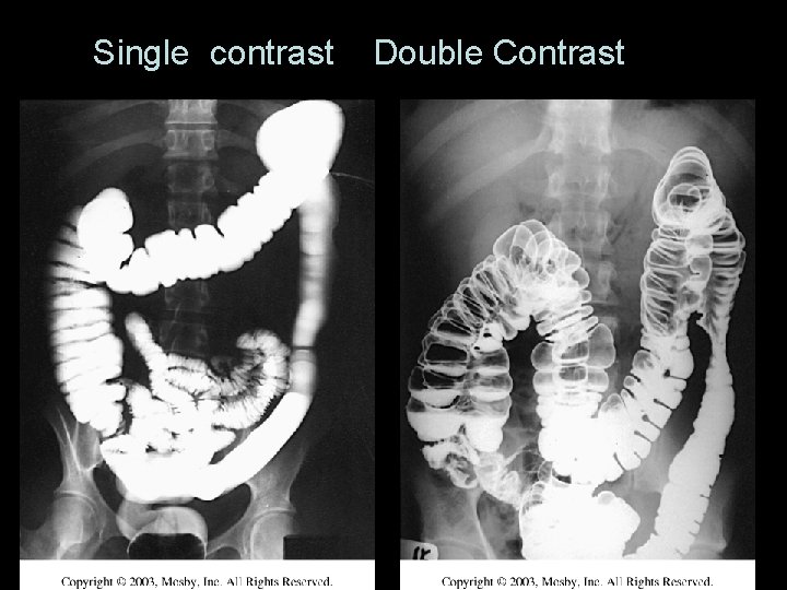 52 Single contrast Double Contrast 52 Single contrast Double Contrast