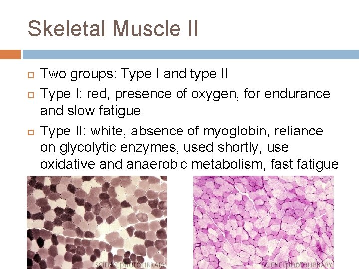 Skeletal Muscle II Two groups: Type I and type II Type I: red, presence Skeletal Muscle II Two groups: Type I and type II Type I: red, presence