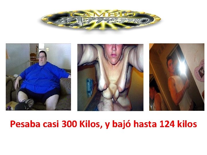 Pesaba casi 300 Kilos, y bajó hasta 124 kilos 