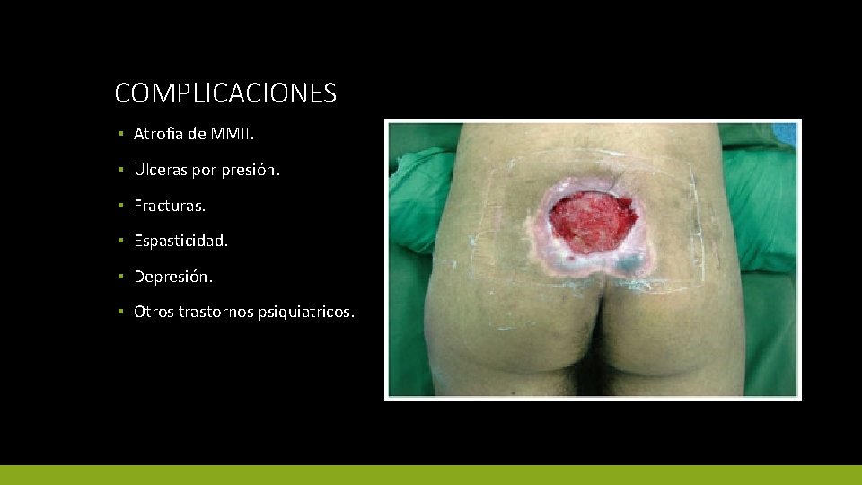 COMPLICACIONES ▪ Atrofia de MMII. ▪ Ulceras por presión. ▪ Fracturas. ▪ Espasticidad. ▪