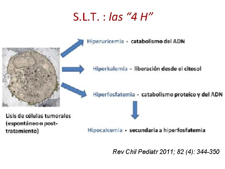 S. L. T. : las “ 4 H” Rev Chil Pediatr 2011; 82 (4):