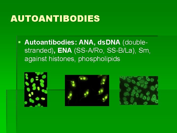 AUTOANTIBODIES § Autoantibodies: ANA, ds. DNA (doublestranded), ENA (SS-A/Ro, SS-B/La), Sm, against histones, phospholipids