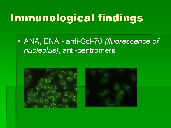 Immunological findings § ANA, ENA - anti-Scl-70 (fluorescence of nucleolus), anti-centromers 