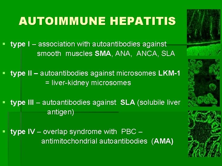 AUTOIMMUNE HEPATITIS § type I – association with autoantibodies against smooth muscles SMA, ANCA,