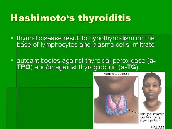 Hashimoto‘s thyroiditis § thyroid disease result to hypothyroidism on the base of lymphocytes and