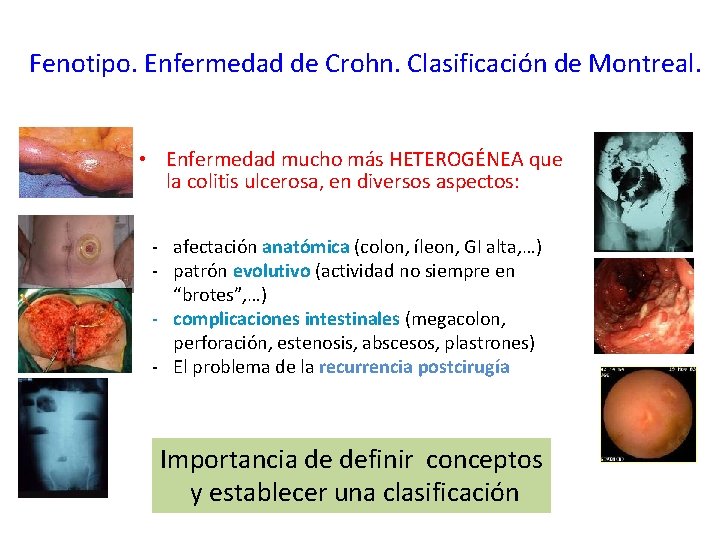 Fenotipo. Enfermedad de Crohn. Clasificación de Montreal. • Enfermedad mucho más HETEROGÉNEA que la