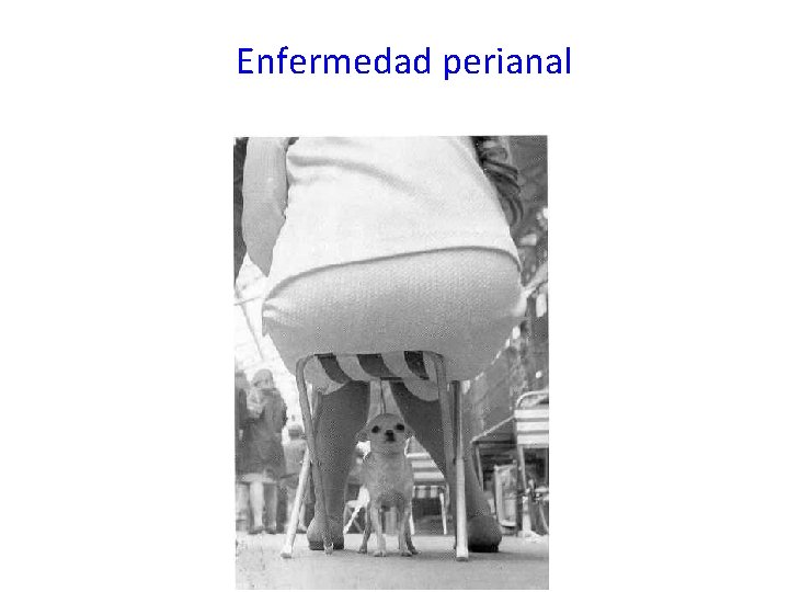 Enfermedad perianal 