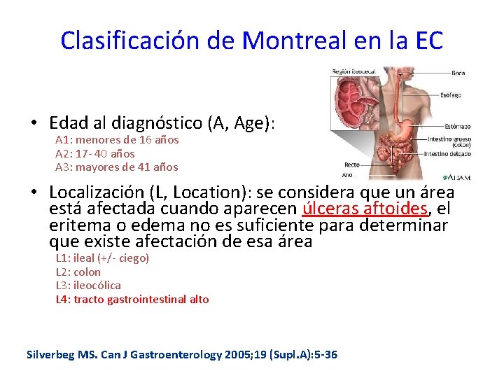 Clasificación de Montreal en la EC • Edad al diagnóstico (A, Age): A 1: