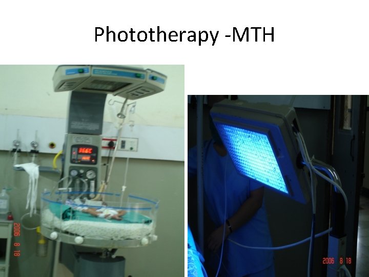 Phototherapy -MTH 