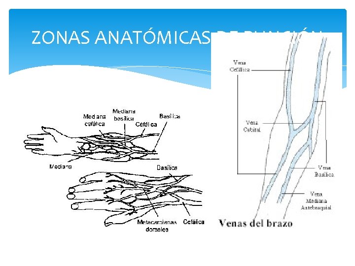 ZONAS ANATÓMICAS DE PUNCIÓN 
