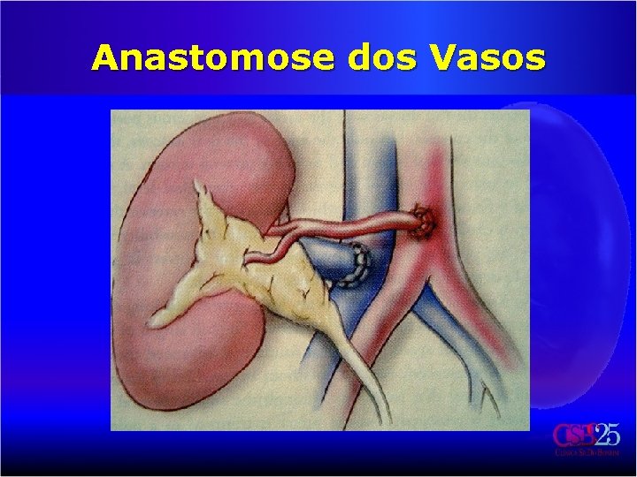 Anastomose dos Vasos 