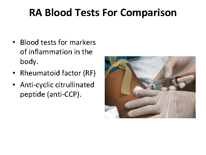 RA Blood Tests For Comparison • Blood tests for markers of inflammation in the