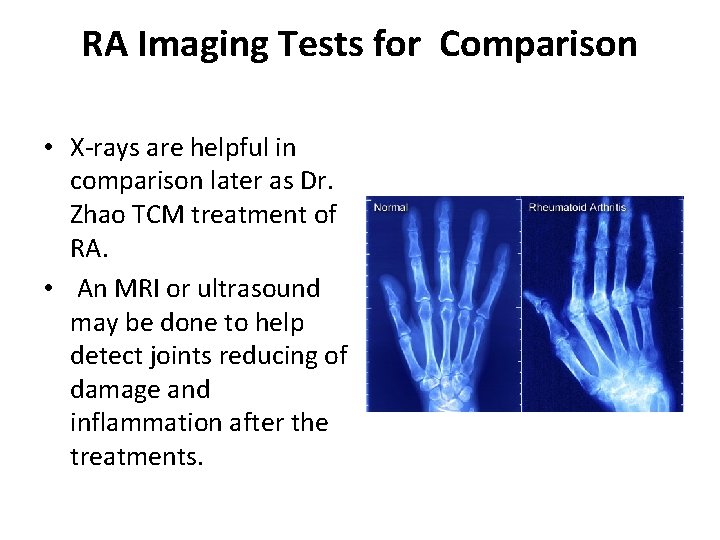 RA Imaging Tests for Comparison • X-rays are helpful in comparison later as Dr.