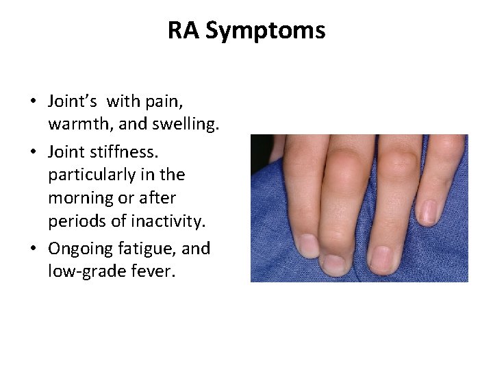 RA Symptoms • Joint’s with pain, warmth, and swelling. • Joint stiffness. particularly in