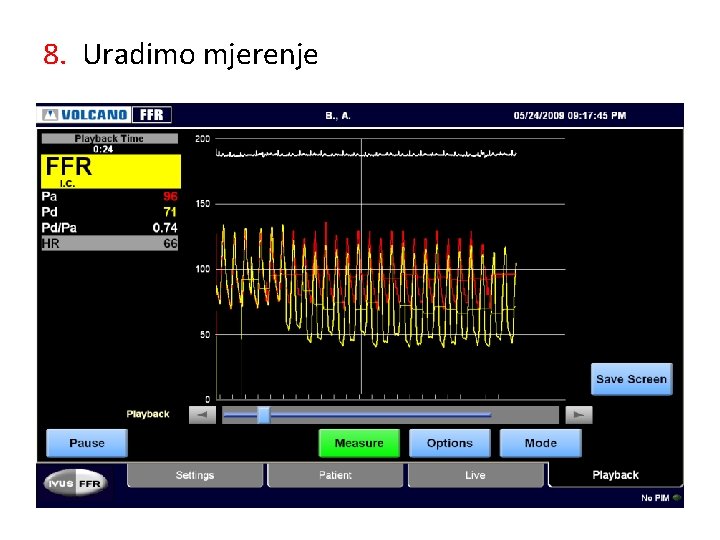 8. Uradimo mjerenje 