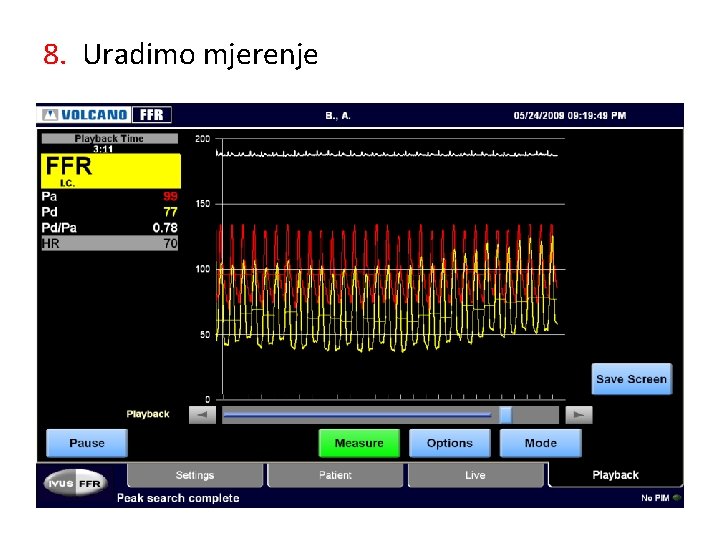 8. Uradimo mjerenje 