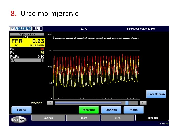 8. Uradimo mjerenje 