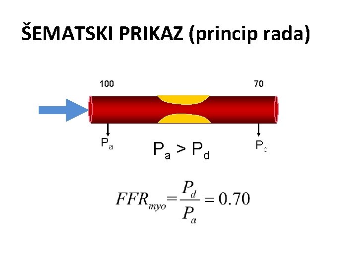 ŠEMATSKI PRIKAZ (princip rada) 100 70 Pa Pd Pa > P d 