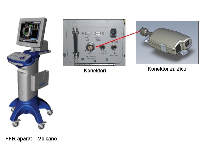 Konektori FFR aparat - Volcano Konektor za žicu 