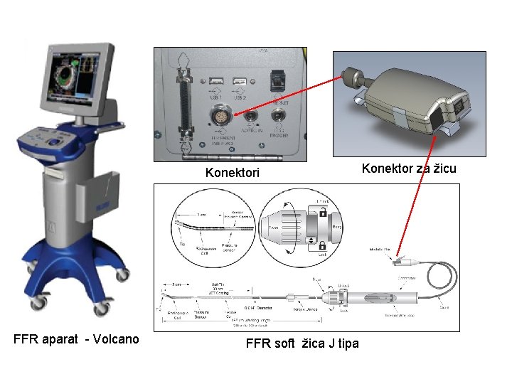 Konektori FFR aparat - Volcano FFR soft žica J tipa Konektor za žicu 