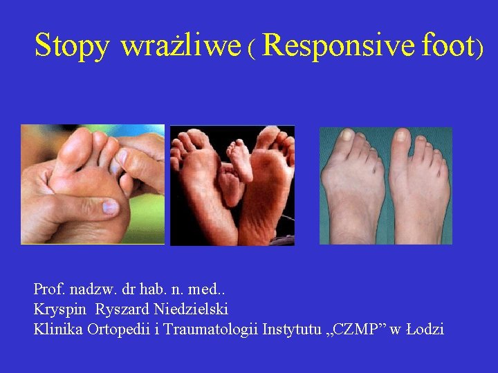 Stopy wrażliwe ( Responsive foot) Prof. nadzw. dr hab. n. med. . Kryspin Ryszard
