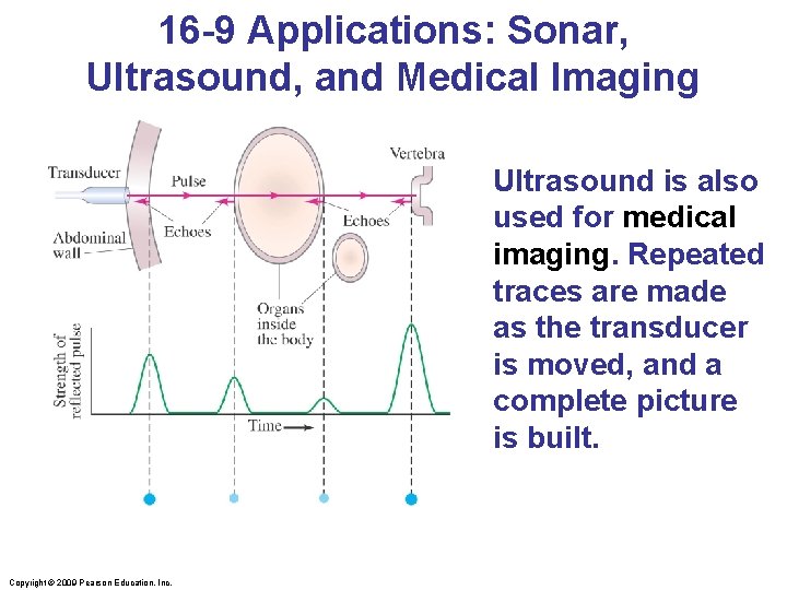16 -9 Applications: Sonar, Ultrasound, and Medical Imaging Ultrasound is also used for medical