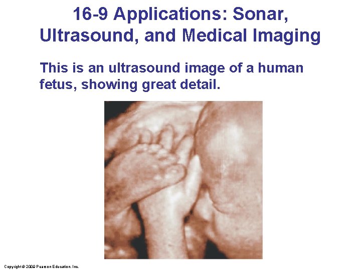 16 -9 Applications: Sonar, Ultrasound, and Medical Imaging This is an ultrasound image of