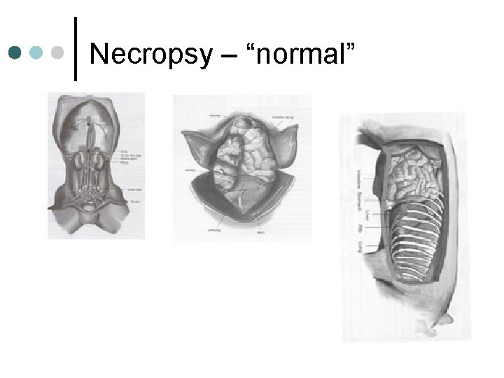Necropsy – “normal” 