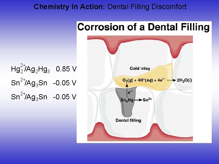 Chemistry In Action: Dental Filling Discomfort 2+ Hg 2 /Ag 2 Hg 3 0.