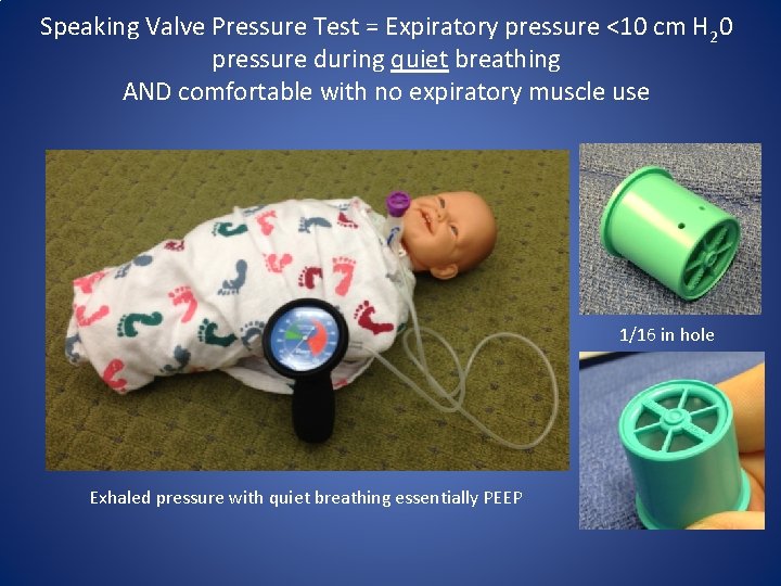 Speaking Valve Pressure Test = Expiratory pressure <10 cm H 20 pressure during quiet