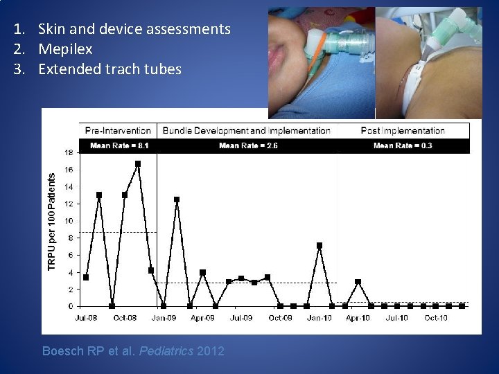 1. Skin and device assessments 2. Mepilex 3. Extended trach tubes Boesch RP et