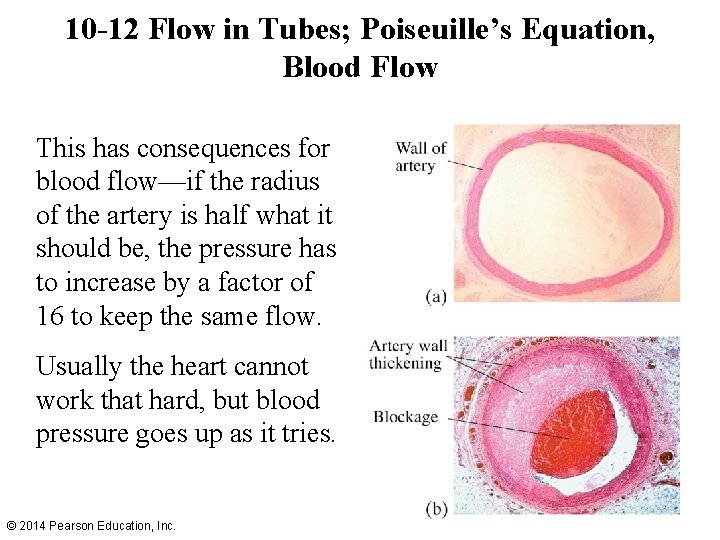 10 -12 Flow in Tubes; Poiseuille’s Equation, Blood Flow This has consequences for blood 10 -12 Flow in Tubes; Poiseuille’s Equation, Blood Flow This has consequences for blood