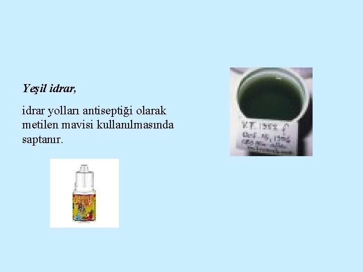 Yeşil idrar, idrar yolları antiseptiği olarak metilen mavisi kullanılmasında saptanır. 