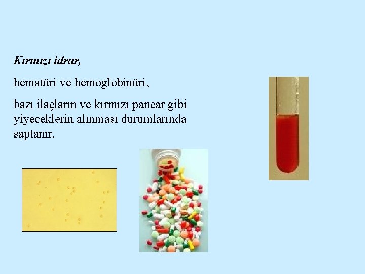 Kırmızı idrar, hematüri ve hemoglobinüri, bazı ilaçların ve kırmızı pancar gibi yiyeceklerin alınması durumlarında