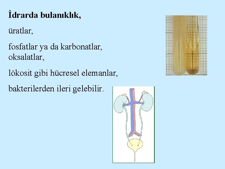 İdrarda bulanıklık, üratlar, fosfatlar ya da karbonatlar, oksalatlar, lökosit gibi hücresel elemanlar, bakterilerden ileri