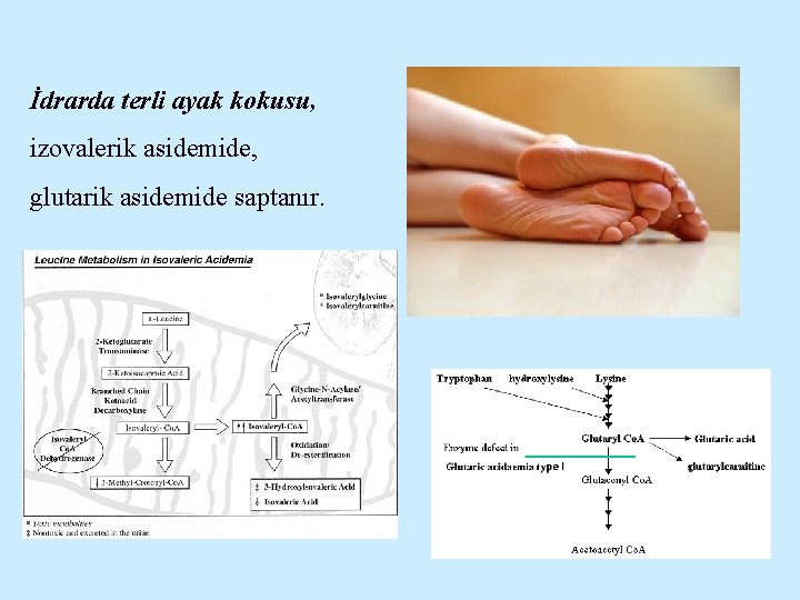 İdrarda terli ayak kokusu, izovalerik asidemide, glutarik asidemide saptanır. 