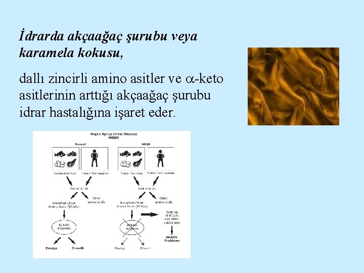 İdrarda akçaağaç şurubu veya karamela kokusu, dallı zincirli amino asitler ve -keto asitlerinin arttığı