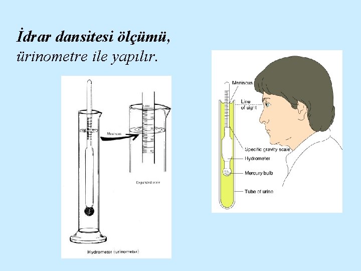 İdrar dansitesi ölçümü, ürinometre ile yapılır. 