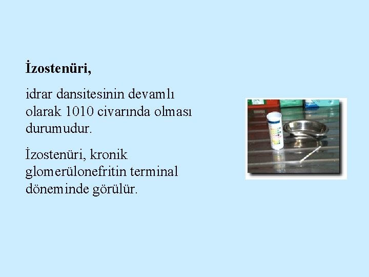 İzostenüri, idrar dansitesinin devamlı olarak 1010 civarında olması durumudur. İzostenüri, kronik glomerülonefritin terminal döneminde