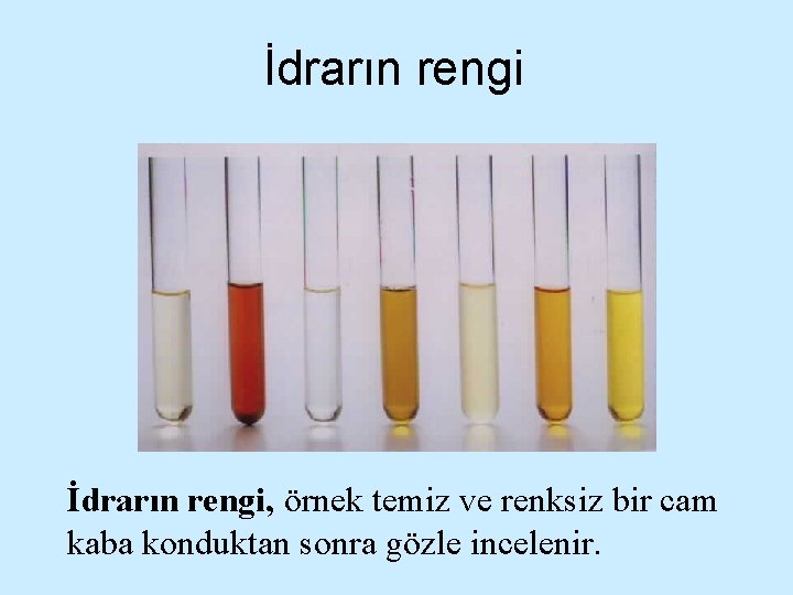 İdrarın rengi, örnek temiz ve renksiz bir cam kaba konduktan sonra gözle incelenir. 