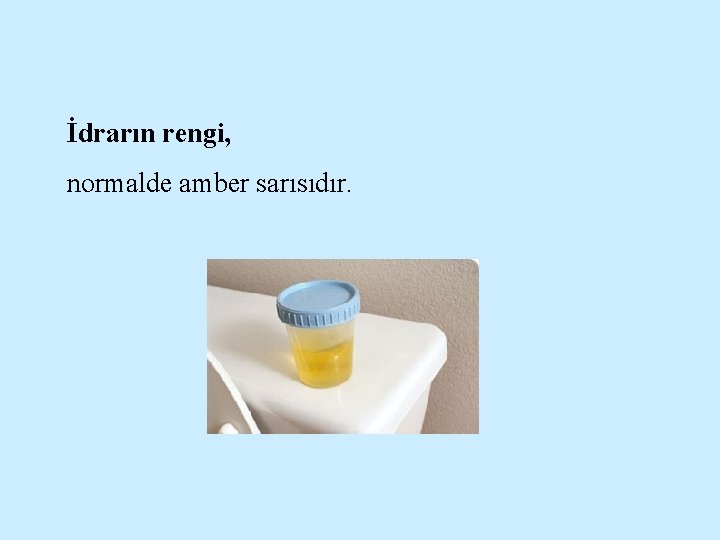 İdrarın rengi, normalde amber sarısıdır. 