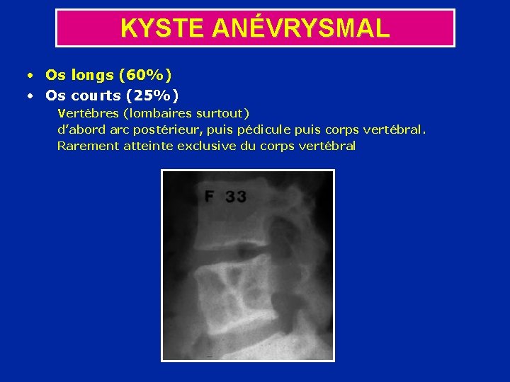 KYSTE ANÉVRYSMAL • Os longs (60%) • Os courts (25%) Vertèbres (lombaires surtout) d’abord