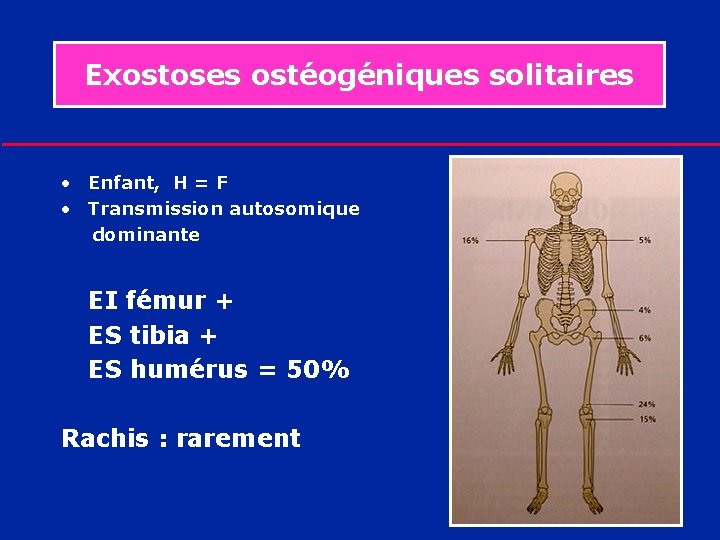 Exostoses ostéogéniques solitaires • Enfant, H = F • Transmission autosomique dominante EI fémur