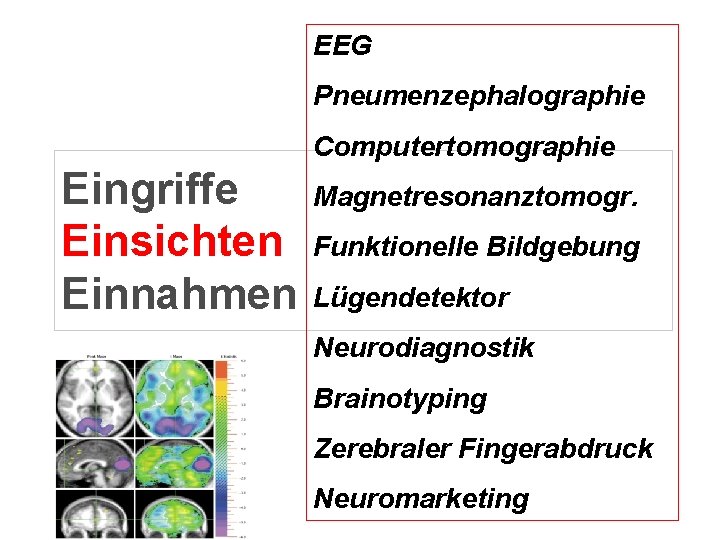 EEG Pneumenzephalographie Computertomographie Eingriffe Einsichten Einnahmen Magnetresonanztomogr. Funktionelle Bildgebung Lügendetektor Neurodiagnostik Brainotyping Zerebraler Fingerabdruck