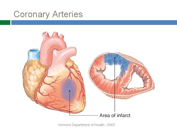 Coronary Arteries Vermont Department of Health - EMS 